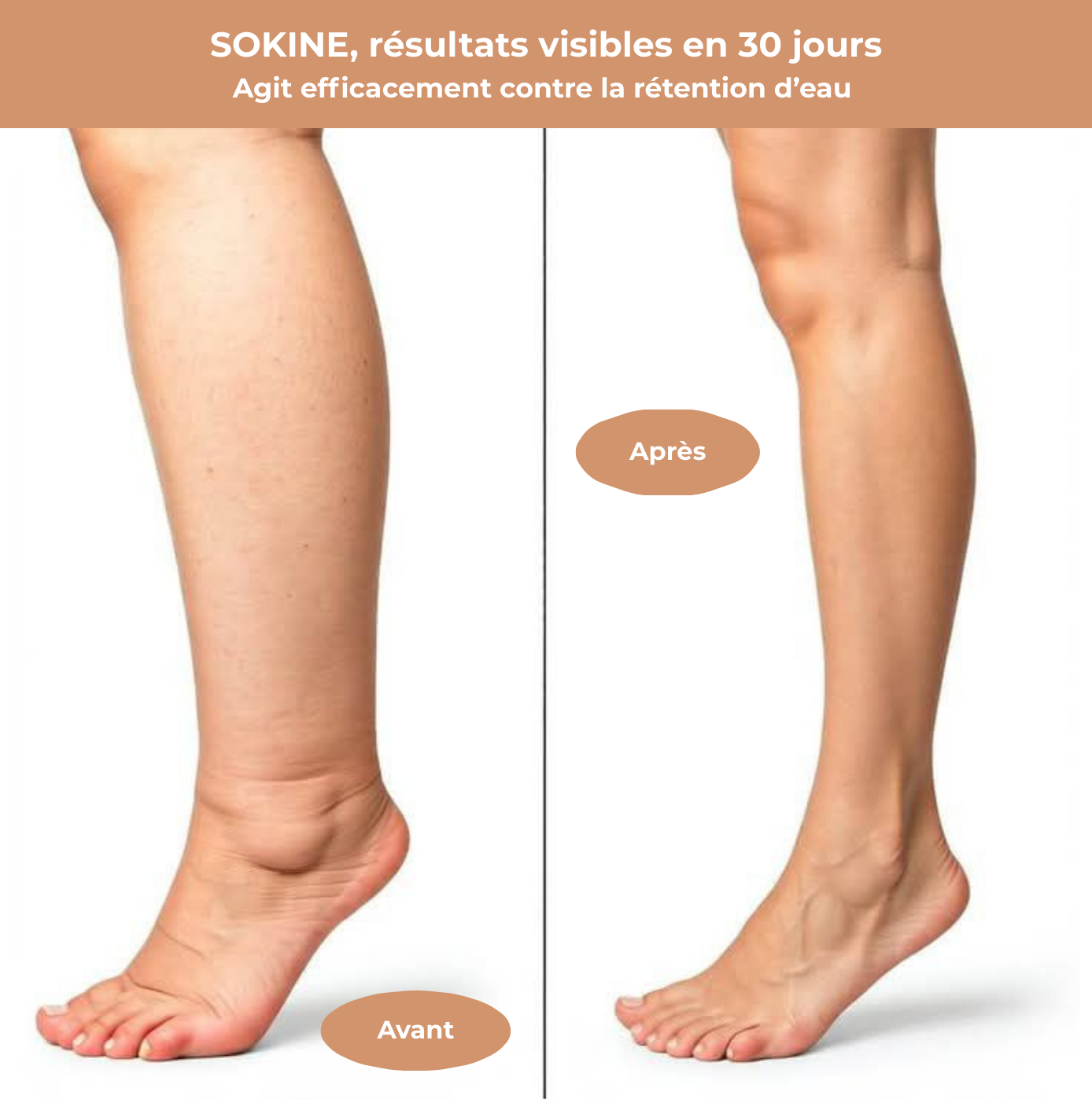 La chaussette SOKINE